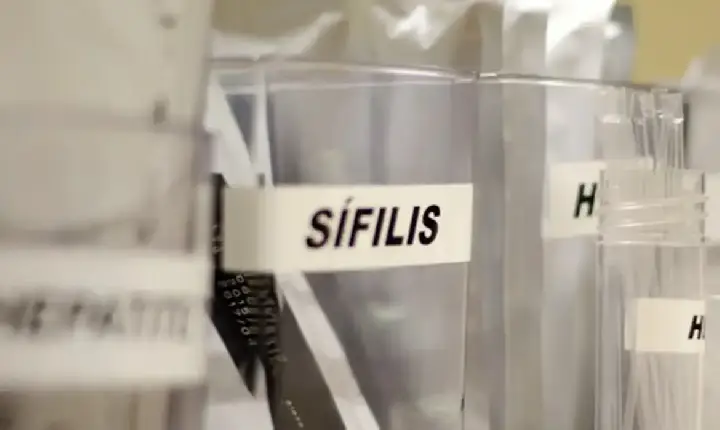 Centro de SP tem testagem grátis de HIV, hepatite, síflis e gonorreia