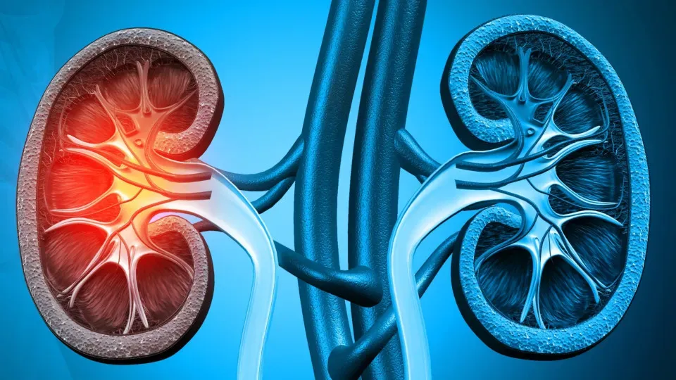 Câncer renal: tumor apresenta sinais somente em estágios avançados