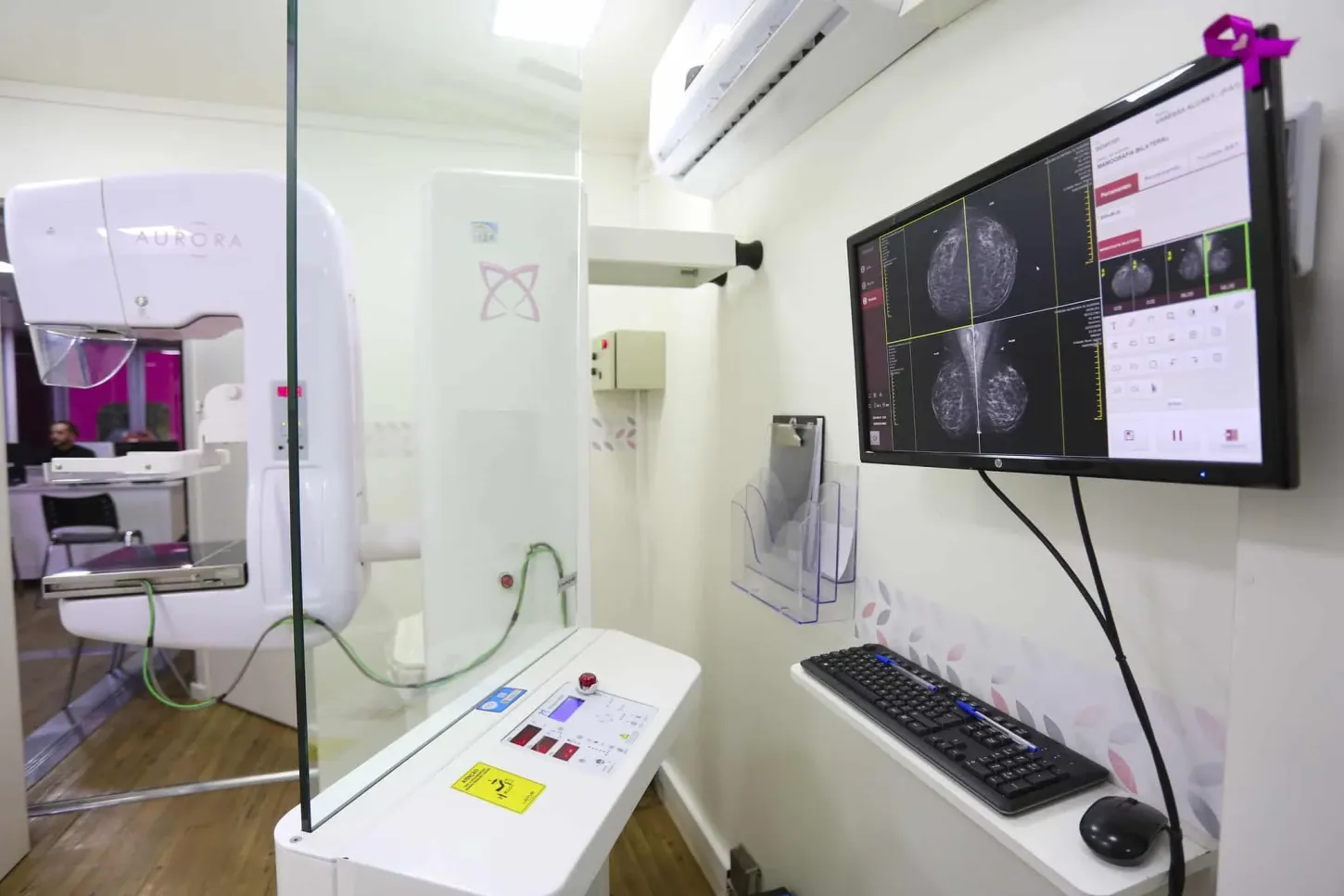 Carretas de prevenção ao câncer de mama realizam exames gratuitos em cinco municípios paulistas